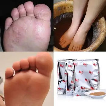 Порошок для ванны для ног Anti Beriberi Уход за ногами Нога спортсмена Запах ног Пот Зуд Пилинг Авитаминоз