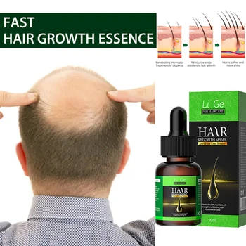 Масло для роста волос Быстрый рост волос Эффективное восстановление облысения Наследственное послеродовое выпадение волос Себорейное выпадение волос